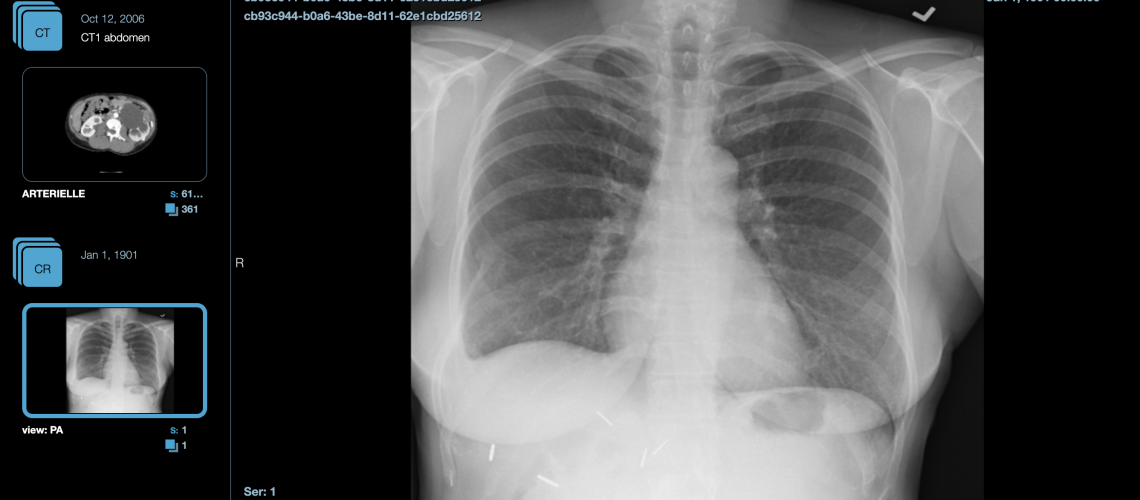 Images médicales du COVID-19 et BondiShare